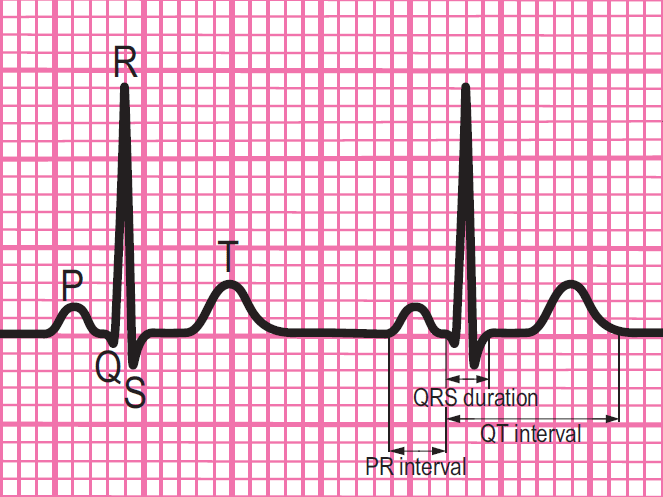 <p>Components of a normal ECG – close up of QRS complex.</p><p></p>