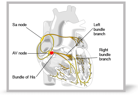 Resuscitation Council (UK) - Advanced Life Support - How do I understand  the basic physiology of the ECG?
