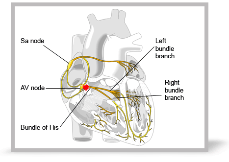 Cardiac Conduction System Animation Cardiac Conduction System Animation