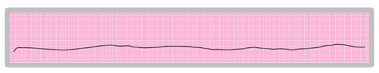 <p>A section of an ECG rhythm strip that shows asystole. </p><p></p>