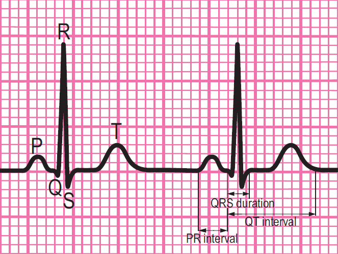 <p>Components of a normal ECG – close up of a rhythm strip.</p><p></p>