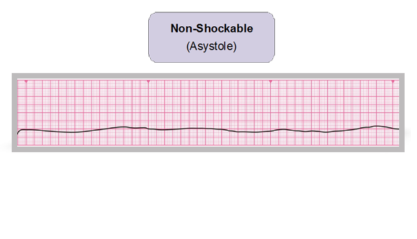 An electrocardiogram.