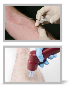 Two images of blood taking.