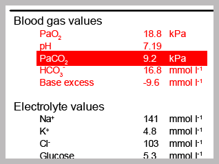 A picture of a patient’s ABG printout with the PaCO [sub]2[/sub]circled. 