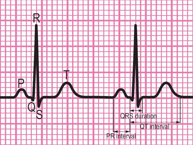 <p>Components of a normal ECG complex.</p><p></p>