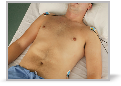 A patient with electrodes to monitor the ECG.