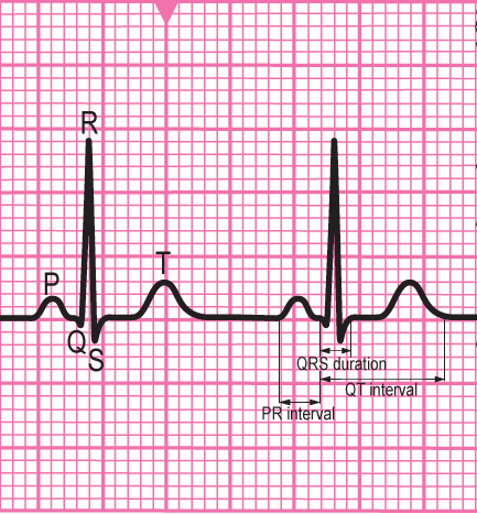 Resuscitation Council (UK) - Advanced Life Support - Interpreting the ECG